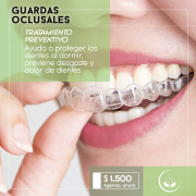 Guardas Oclusales